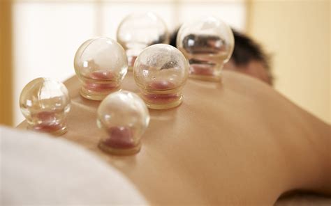 What Is Cupping Does It Work Summars Beauty And Cupping