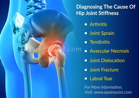 Hip Pain Stiffness Causes The Hip Flexor