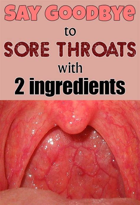 Say Goodbye To Sore Throats With 2 Ingredients