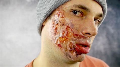 3rd Degree Burn Fx Makeup Tutorial Youtube