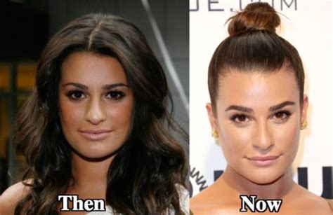 Lea Michele Nose Job Plastic Surgery Before And After Photos Latest Plastic Surgery Gossip And