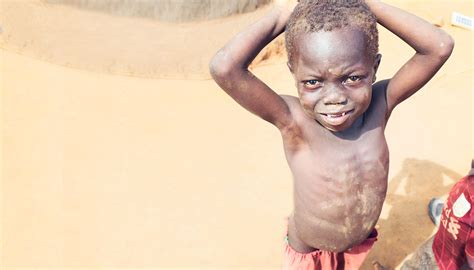 Feed a starving child. Help save his life. | World Help