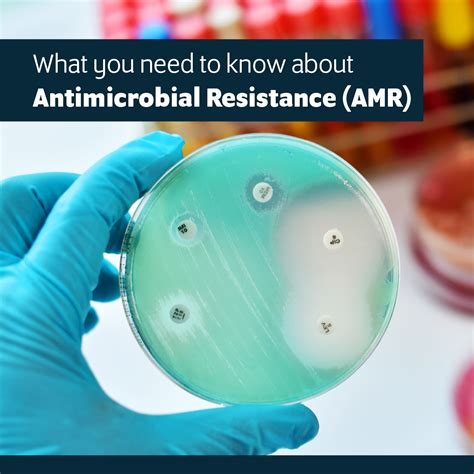 antimicrobial resistance a global healthcare crisis waiting to happen mirius healthcare