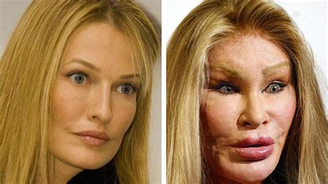 10 People Who Took Plastic Surgery Too Far YouTube