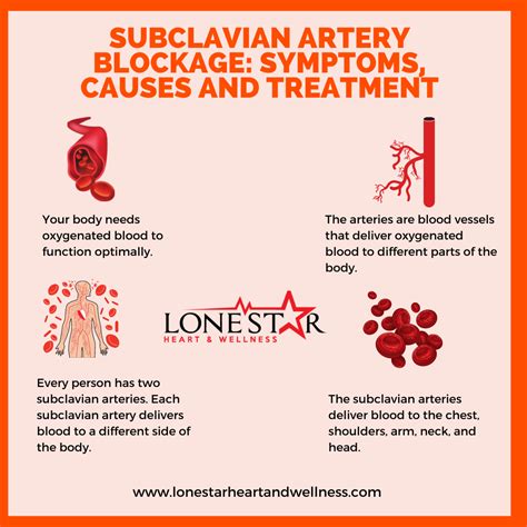 Subclavian Artery Blockage Symptoms And Treatment In Waco Tx