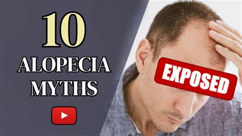 Alopecia Shocking Myths And Facts In Youtube