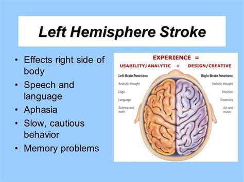 Left Side Brain Stroke Symptoms Mapasebab