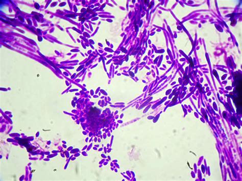 September 2022 Case Of The Month Doctor Fungus