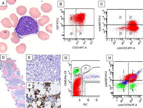 Morphologic Immunohistochemical And Flow Cytometric Findings In