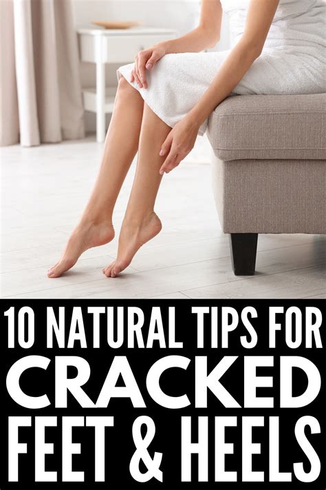 6 Home Remedies For Cracked Heels That Actually Work Artofit