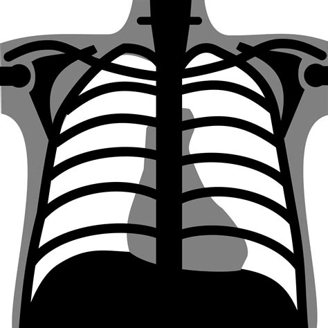 Chest X Ray Clipart 10 Free Cliparts Download Images On Clipground 2021
