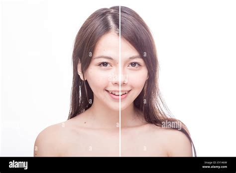 Asian Woman S Face Beauty Concept Before And After Stock Photo Alamy