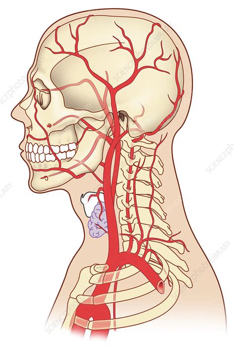 Connective tissue dysplasia, carotid artery dissection, autonomic nervous system, harlequin syndrome. Neck and head arteries, artwork - Stock Image - C010/7079 ...