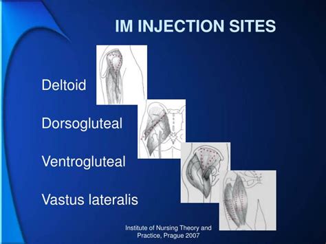 anatomy trainer intramuscular injection sites chart