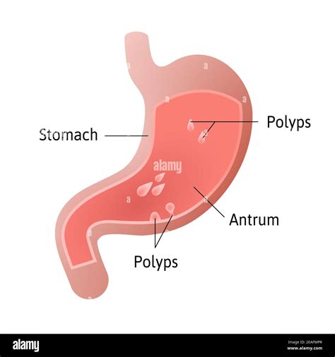 Gastric Lining Stock Vector Images Alamy