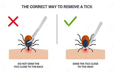 The Correct Way To Remove A Tick Insect Correctly Infographic Tips For