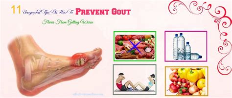 11 Unexpected Tips How To Prevent Gout Flares From Getting Worse