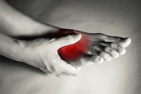 Foot Arch Pain Signs And Causes Dr Stein Blog