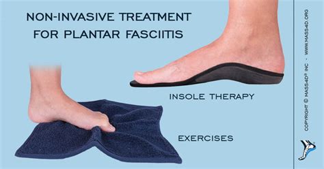Non Surgical Treatments For Plantar Fasciitis Mass4d® Foot Orthotics