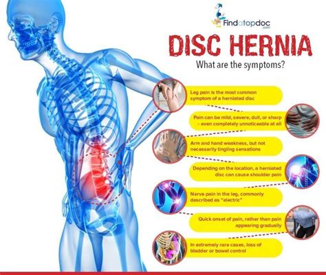 Slipped Herniated Disc Symptoms Causes And Effects Herniated My Xxx
