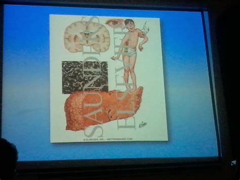 Lecture Slides Paediatrics Chronic Liver Disease