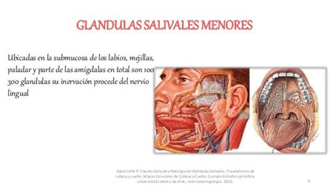 Patologias Glandulas Salivales