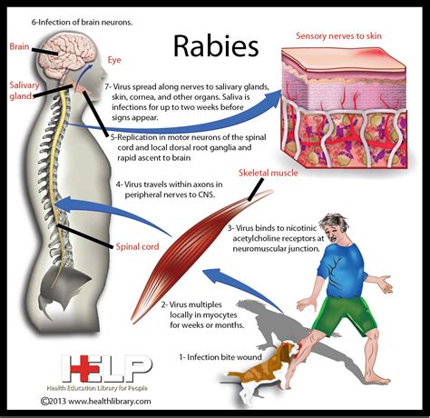 The first symptoms of rabies may be very similar to those of the flu including general weakness or discomfort, fever, or headache. Pin by Nicole Cohen on Infectious Diseases | Nursing ...