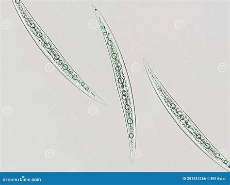 Closterium Sp Charophyta Algae Under Microscopic View X40 Green Algae