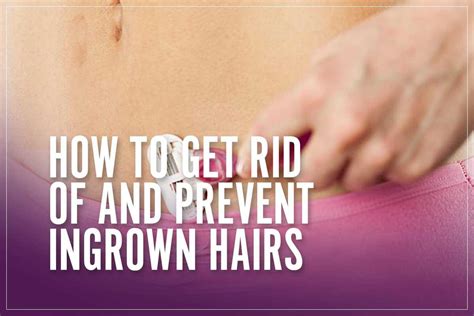 How To Get Rid Of And Prevent Ingrown Hairs [treatment Guide]