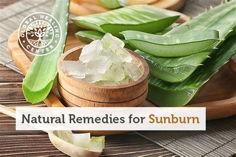 10 Natural Remedies For Sunburn