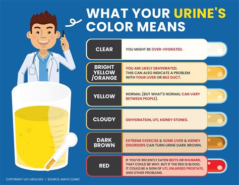 Infographics Urologist Uc Irvine Department Of Urology Urine Color