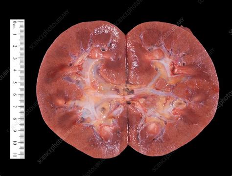 Macro Section Of A Normal Human Kidney Stock Image C0383707