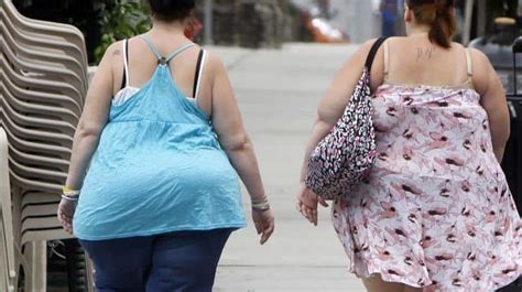 fat shaming and obesity stigma a deterrent to good health upper gi surgery