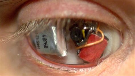Filmmaker Eyeborg Replaced His Deteriorating Eye With A Video Camera