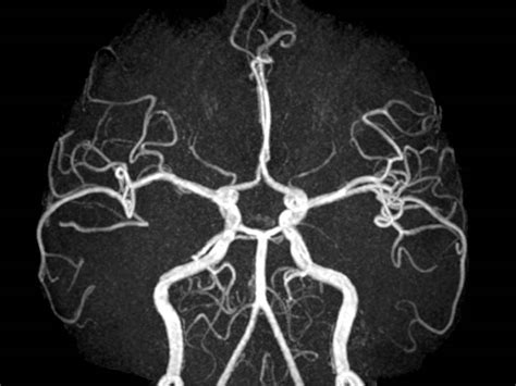 Mri Mra Services At Desert Imaging