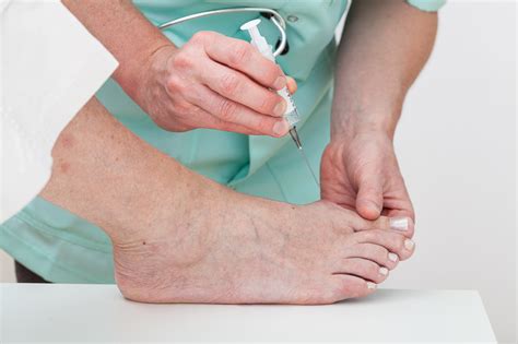 Injection Techniques For Chronic Foot Pain Is An Alternative To Surgery