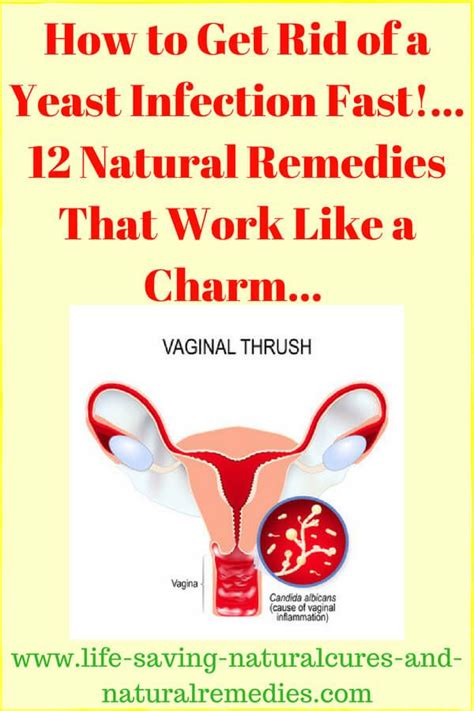How To Get Rid Of A Yeast Infection Fast  12 Home Remedies That Work Like A C