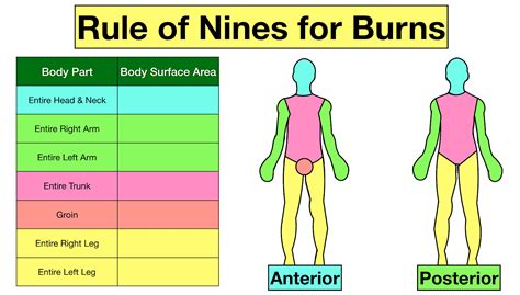 Rule Of Nines For Burns Child And Adult Chart Calculator Definition