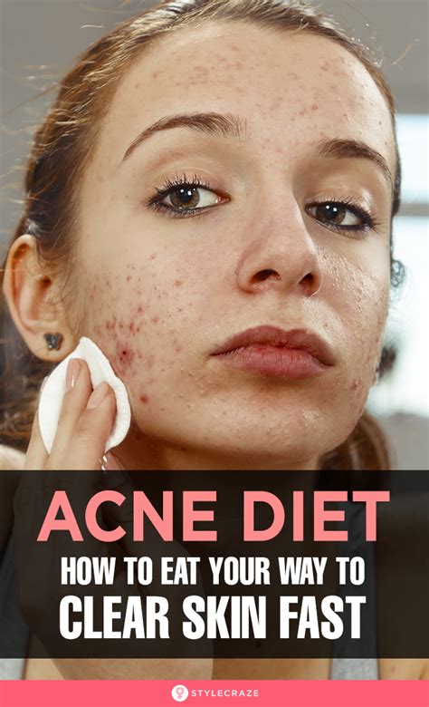 Anti Acne Diet What To Eat For Clearer And Healthier Skin Anti Acne