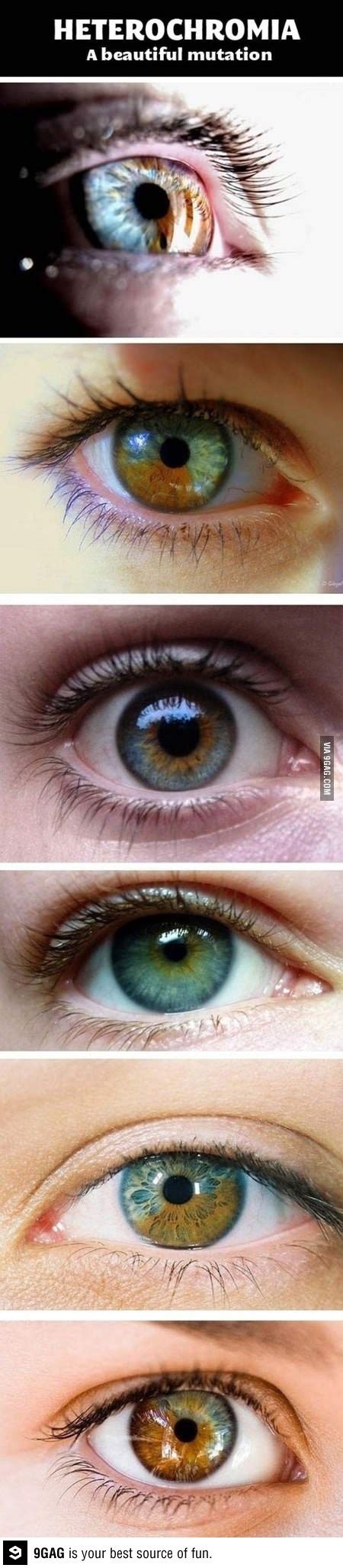 Interesting Heterochromia A Beautiful Eye Mutation Pretty Eyes