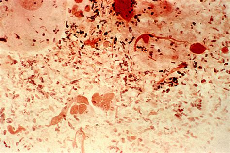 Free Picture Gram Negative Neisseria Gonorrhea Bacteria Paired Hence Term Diplococci