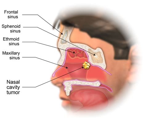 The visible interactive human at ohio university. Nasal Cavity - Anatomy on Radiographs: Intraoral ...