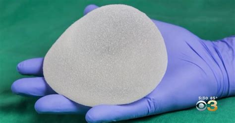 Allergan Recalls Breast Implant Model Linked To Rare And Deadly Form Of Cancer Cbs Philadelphia