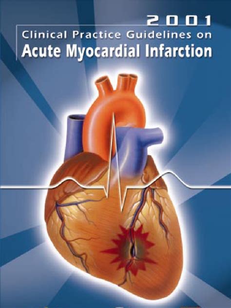 Acute Myocardial Infarction Pdf Coronary Artery Disease