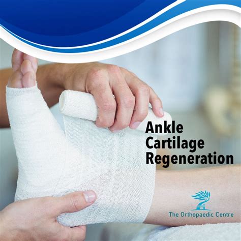 Ankle Cartilage Regeneration Arthroscopic Debridement Sg