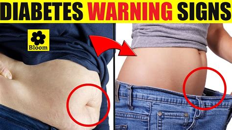 Early Warning Signs Of Diabetes You Shouldnt Ignore Worlddiabetesday Youtube