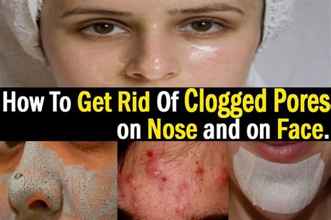 How To Get Rid Of Clogged Pores On Nose And On Face Clogged Pores On