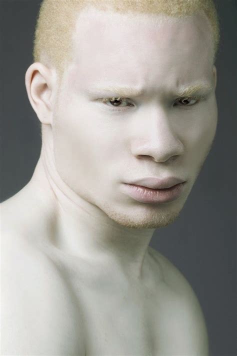 African Albino Portrait Modelo Albino Albino Human Feral Heart