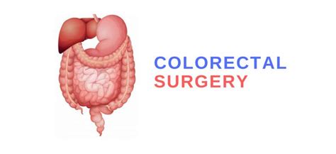 Colorectal Surgery An Introduction And Its Different Types Part 2