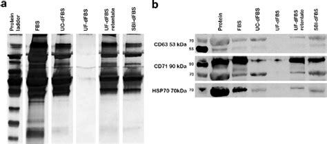 Silver Staining And Western Blotting Of Ev Proteins Analysis Of Total